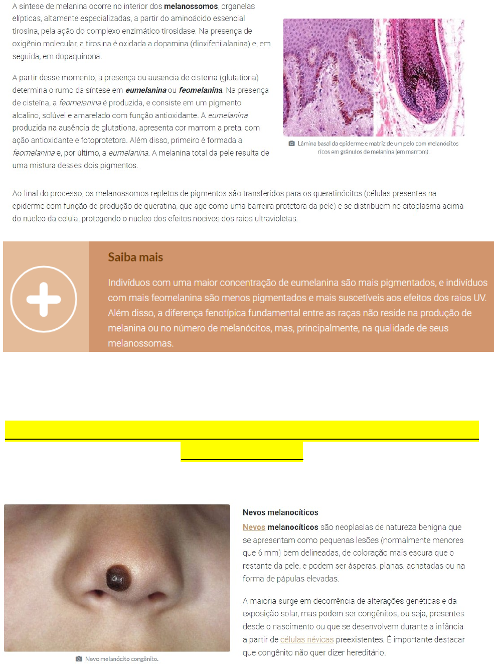 aula-02-disturbios-pigmentares-e-calcifica-es-patologia-i