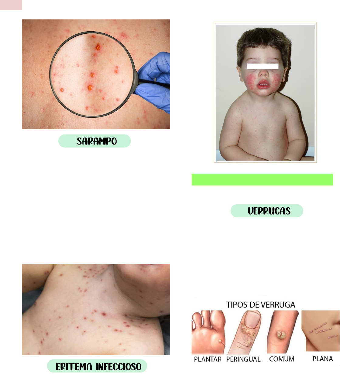 3 informações que você precisa saber sobre dermatite numular e eczema  numular, image size:1119x1232