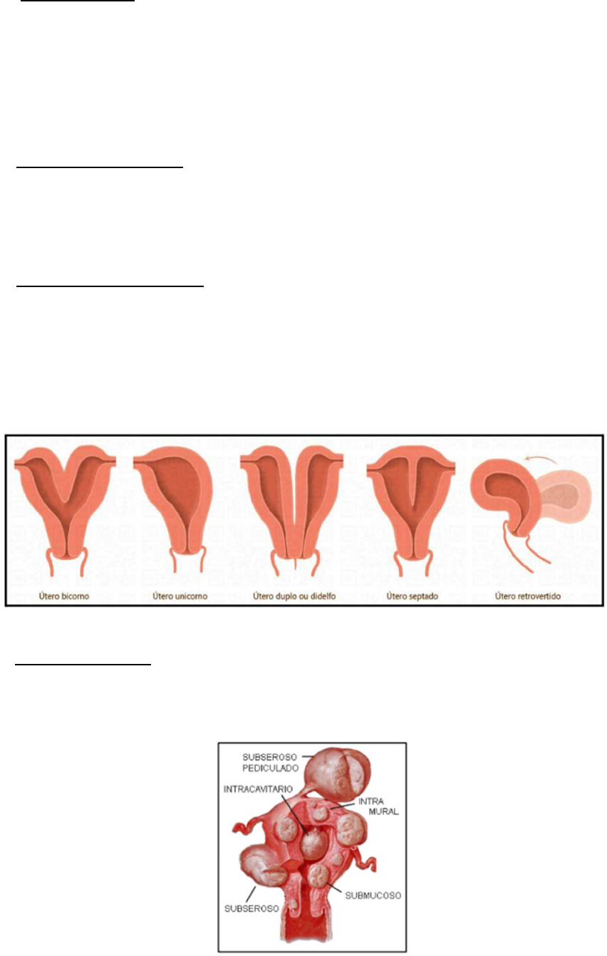 Grátis: Hemorragias na Gestação - Material Claro e Objetivo em PDF para  Estudo Rápido