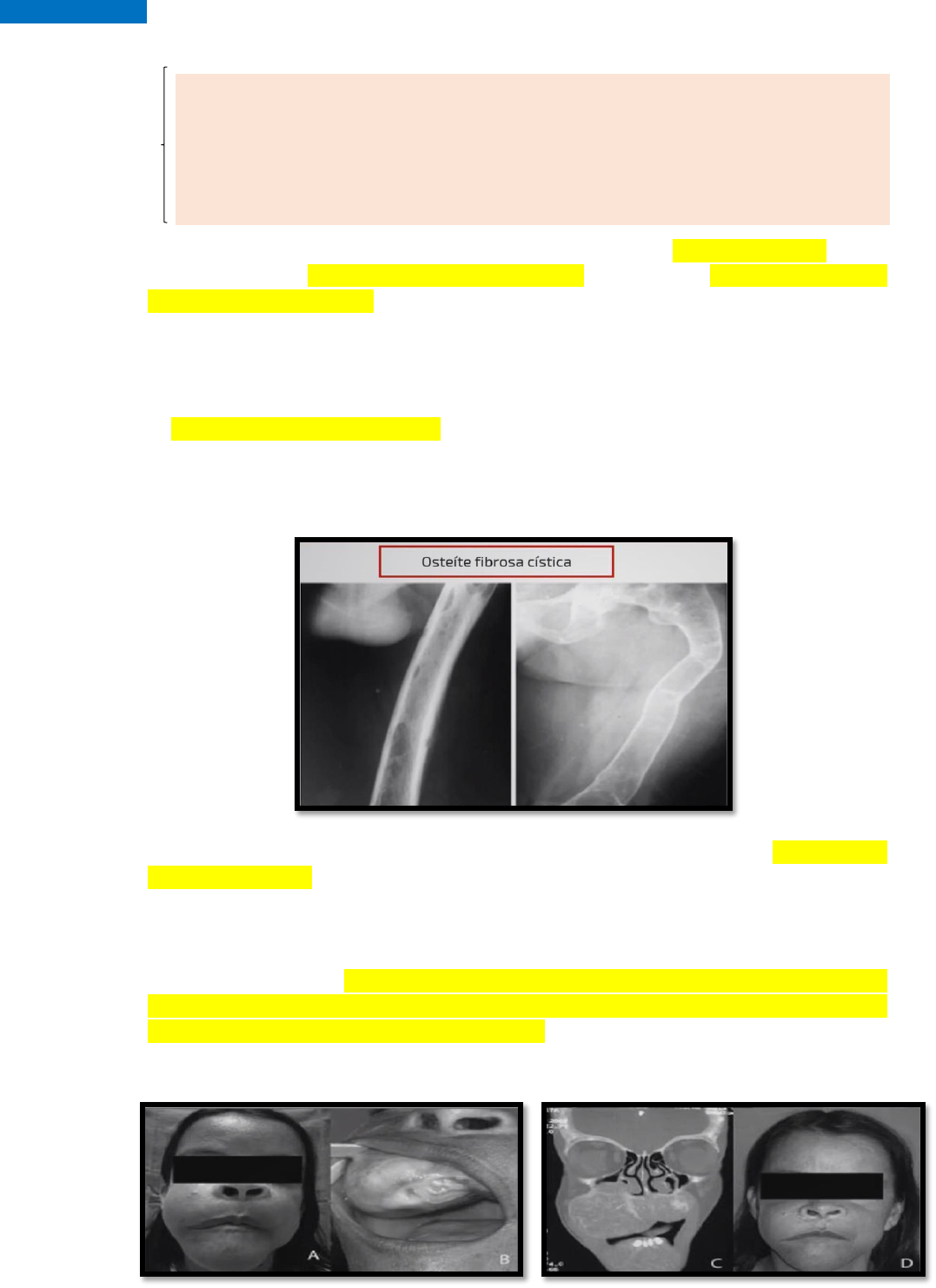 osteíte fibrosa cística radiografia