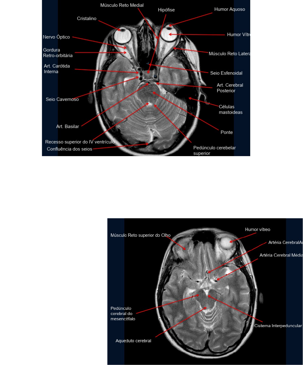 Bronstein - RM, Já imaginou um exame que pode detalhar todos os tecidos do  corpo em imagem, detectar cânceres, mapear a atividade cerebral e, ao  contrário do raio-X, não