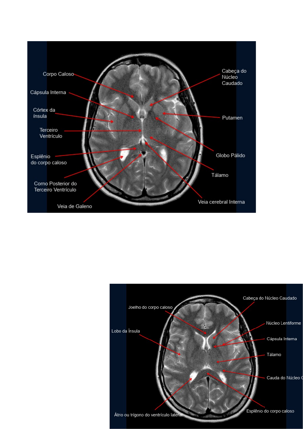 É seguro fazer ressonância magnética? Descubra agora! | TikTok, image size:1031x1459