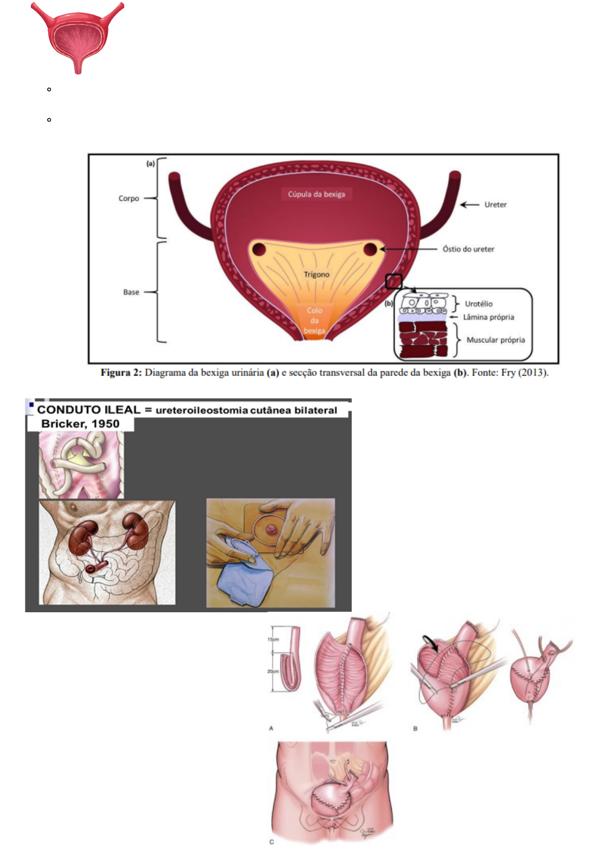 Grátis: CÂNCER DE BEXIGA - Material Claro e Objetivo em PDF para Estudo  Rápido