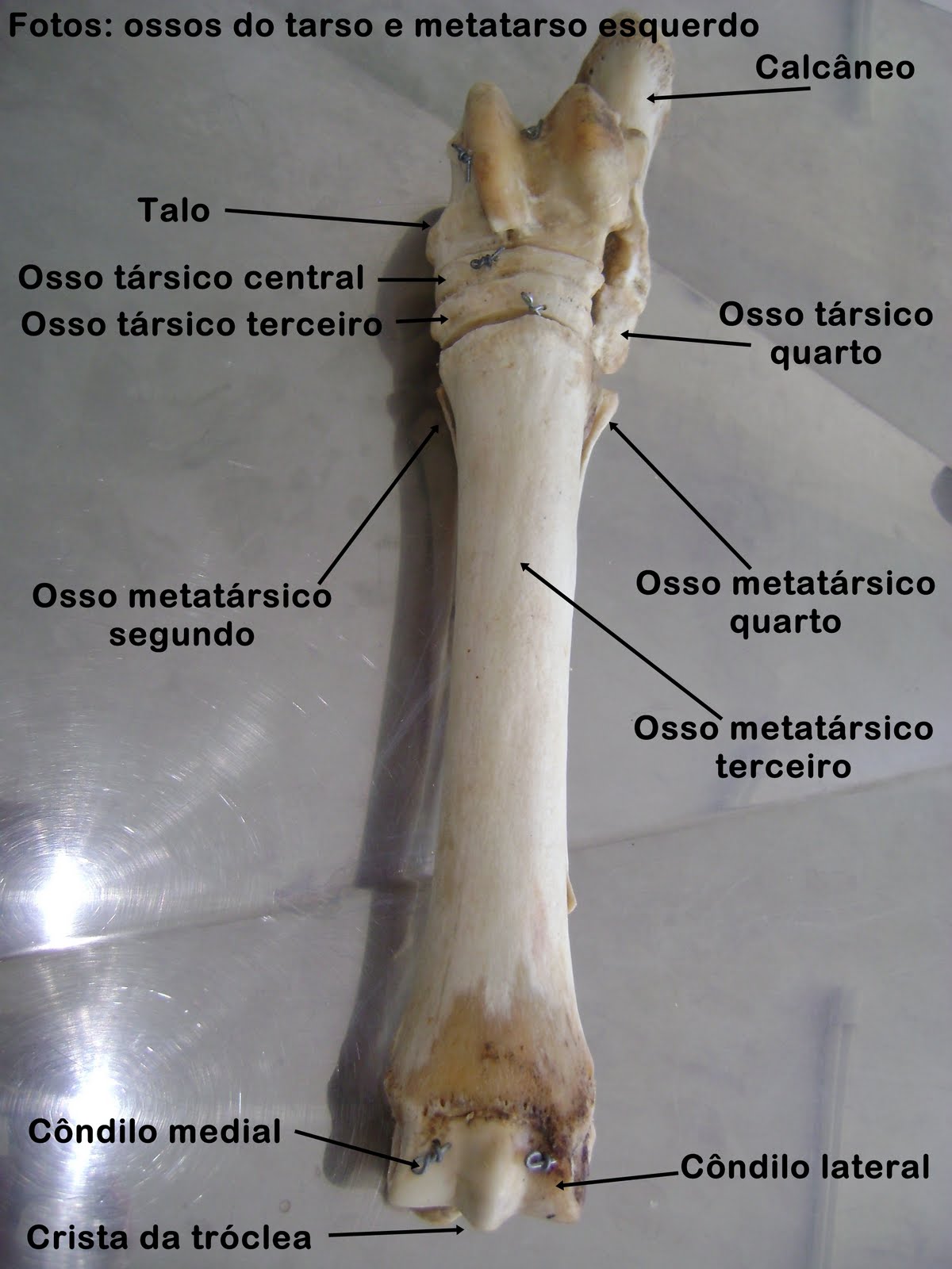 Huesos Del Carpo Anatomia Humana Huesos Anatomia Y Fisiologia Humana