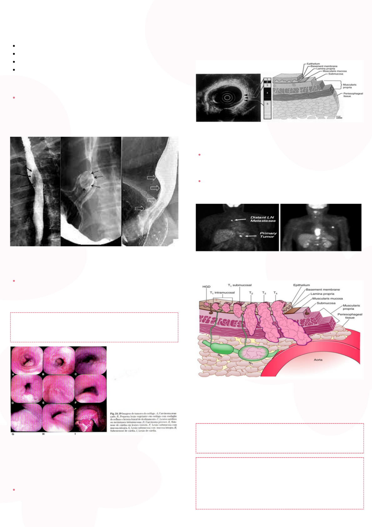 Grátis: Tumores do trato gastrointestinal - Material Claro e Objetivo em  PDF para Estudo Rápido