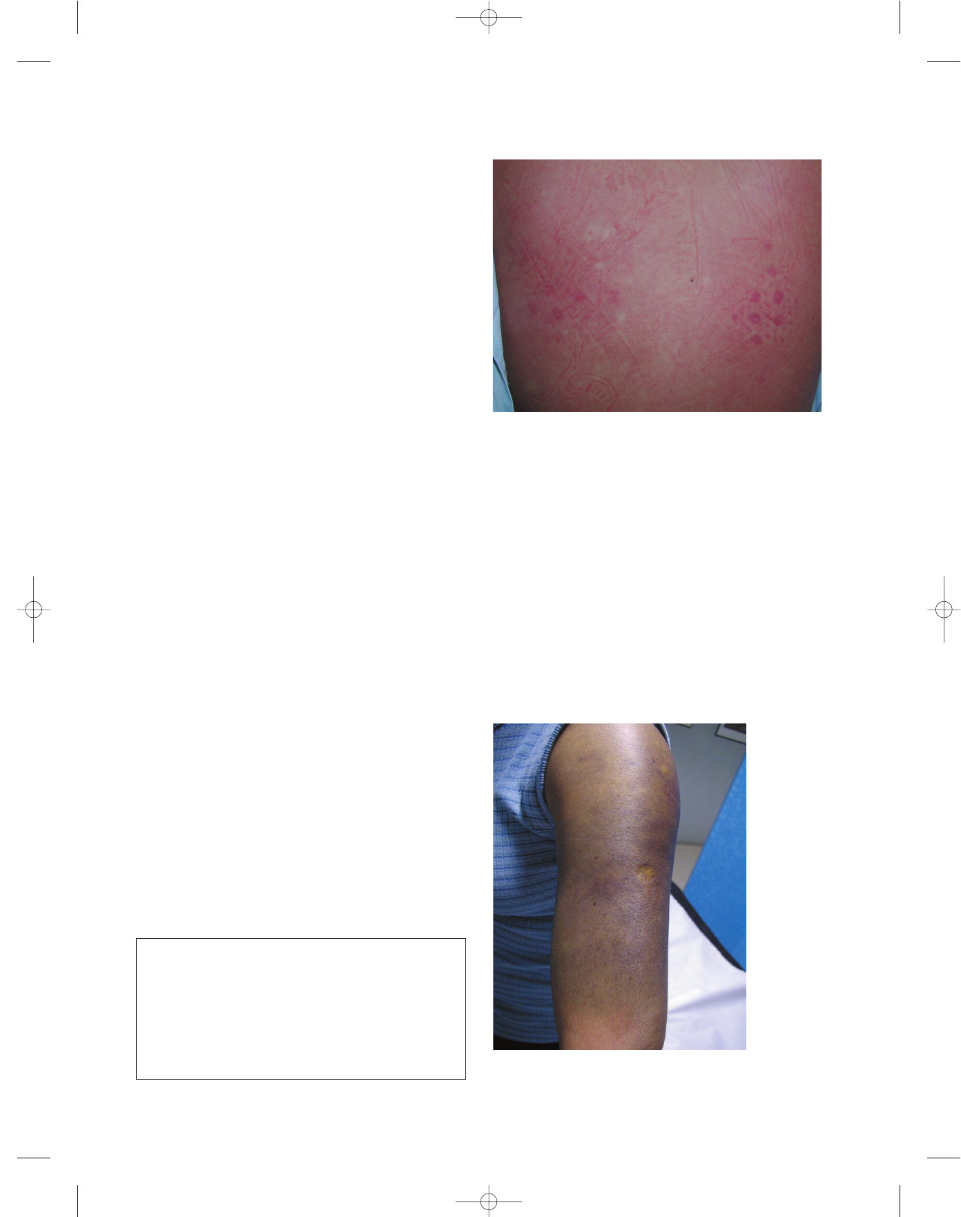 Grátis: Manifestações mucocutâneas da dengue - Material Claro e Objetivo em  PDF para Estudo Rápido, image size:1392x1763