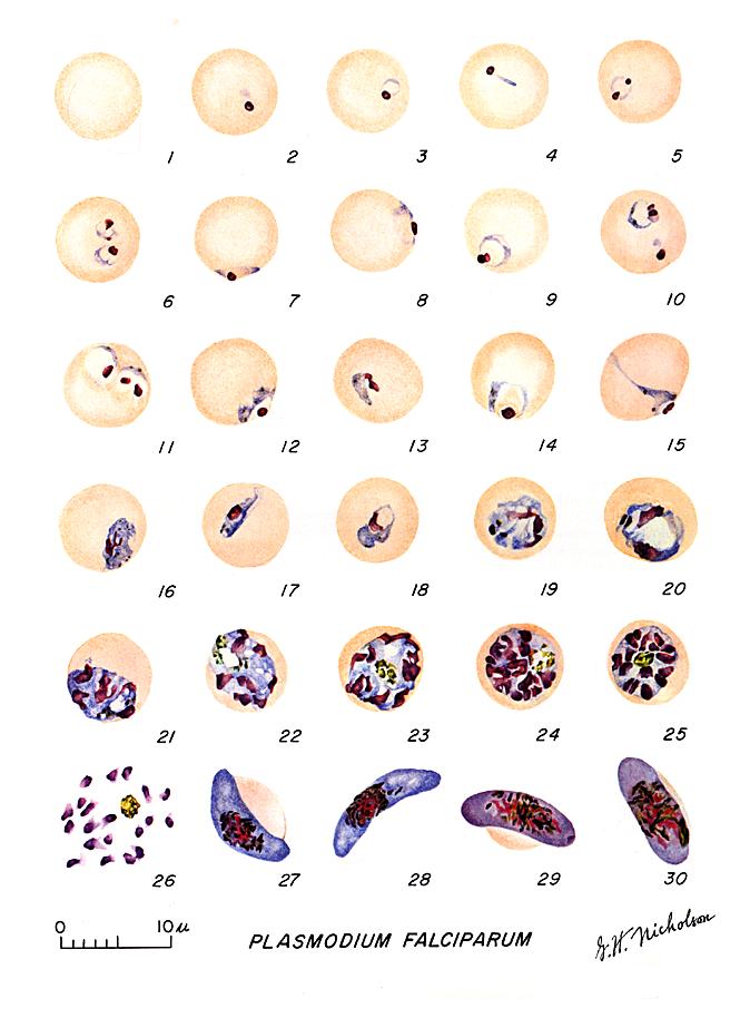 Formas Do Plasmodium Falciparum An Lises Cl Nicas