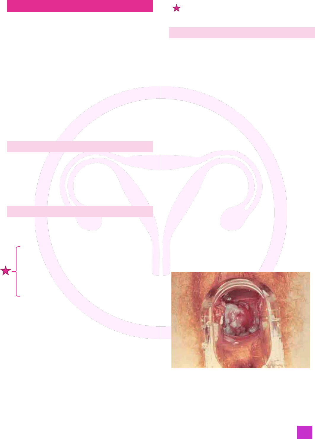 Tratamento de supositórios de vaginite. inflamação da vagina. Infográficos.  ilustração vetorial em fundo isolado imagem vetorial de mikrostoker©  136049596