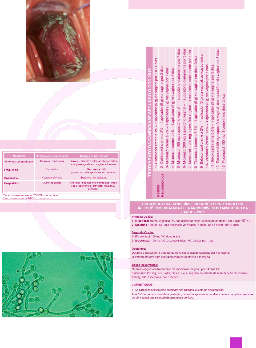 Tratamento de supositórios de vaginite. inflamação da vagina. Infográficos.  ilustração vetorial em fundo isolado imagem vetorial de mikrostoker©  136049596