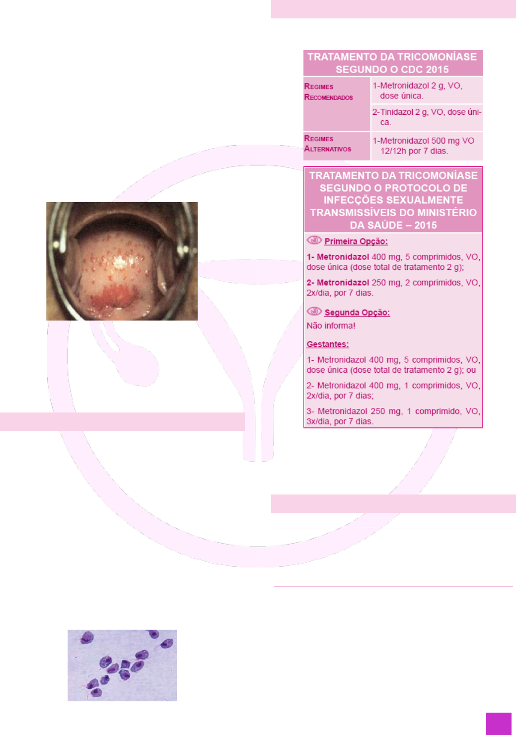 Tratamento de supositórios de vaginite. inflamação da vagina. Infográficos.  ilustração vetorial em fundo isolado imagem vetorial de mikrostoker©  136049596