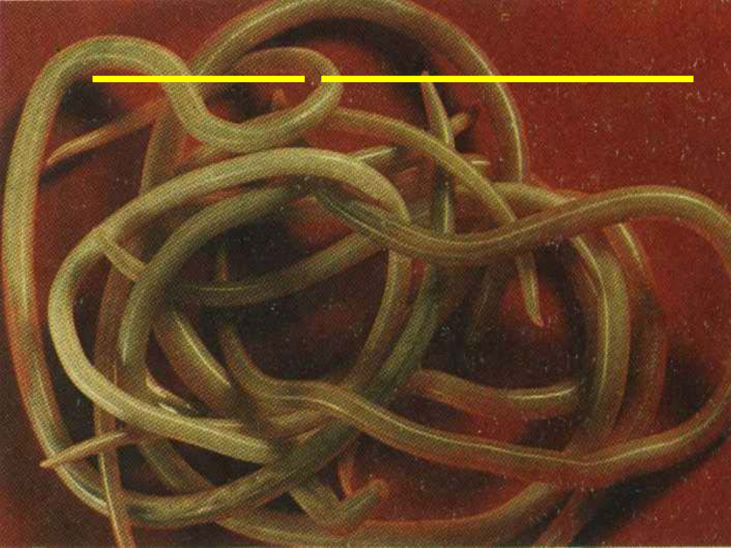 Larva plathelminthe. Utilizator:Jean/Cutia de nisip - Wikipedia