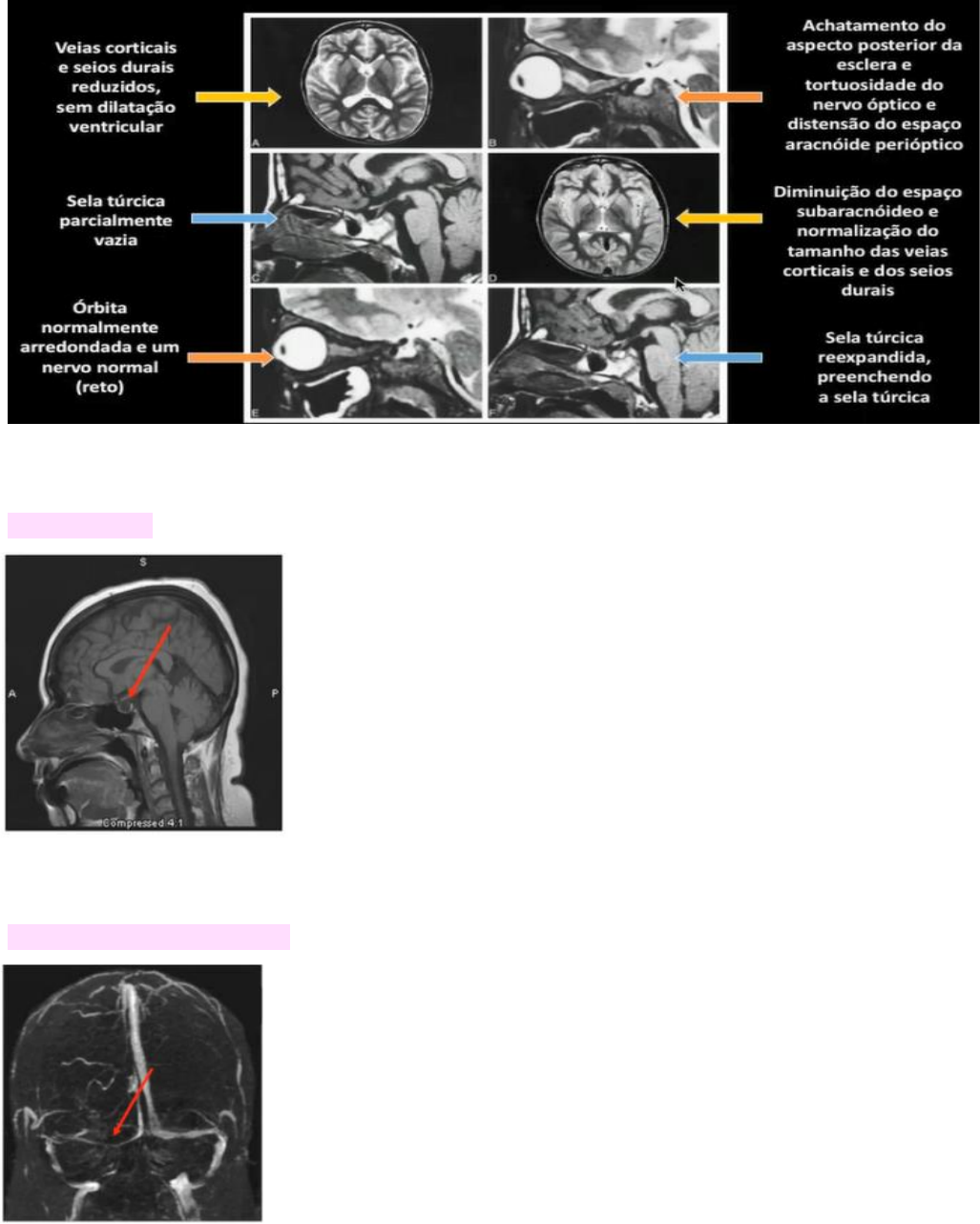 Ressonância magnética (RM) de pescoço, vista sagital , — Fotografia de  stock © Richmanphoto #310887088, image size:1027x1282
