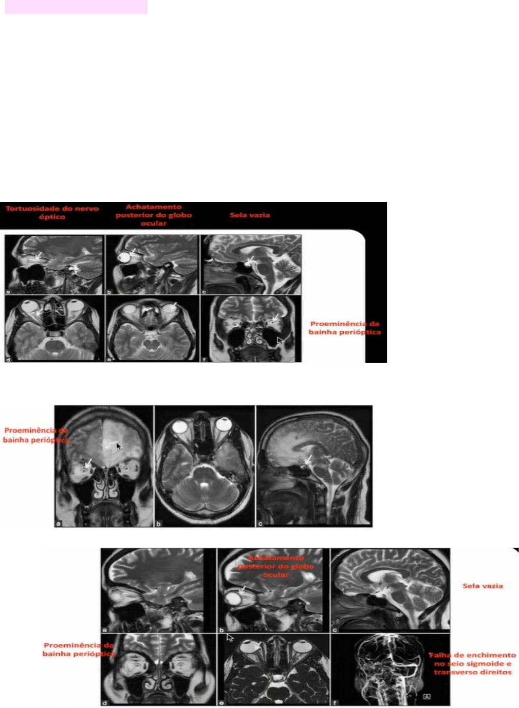 Ressonância Magnética - Clínica Multimagem - Agende seu Exame, image size:1010x1378