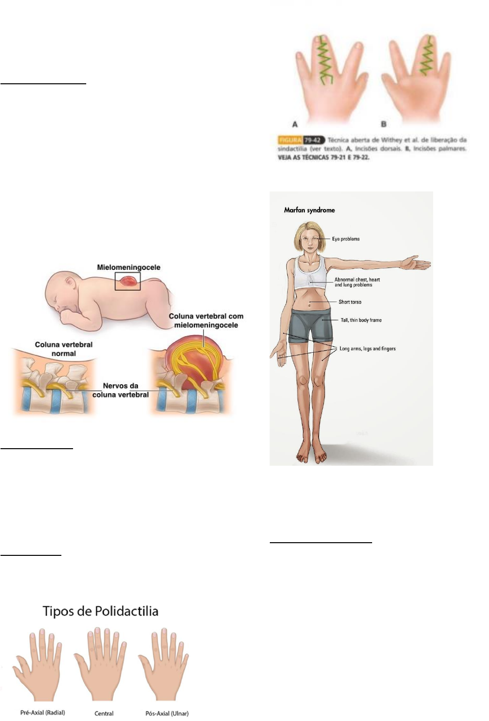 espinha bífida covinha sacral