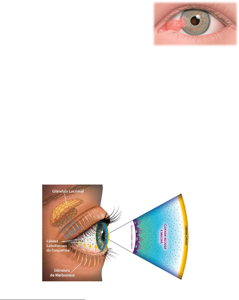 Grátis: Exame físico OLHO - Material Claro e Objetivo em PDF para Estudo  Rápido, image size:821x1029