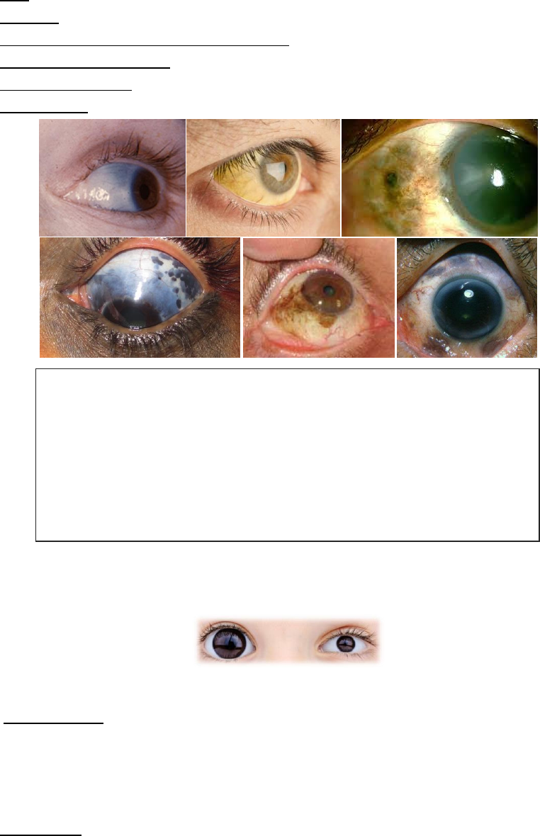 Grátis: Exame físico dos olhos e supercílios - Material Claro e Objetivo em  PDF para Estudo Rápido, image size:762x1180