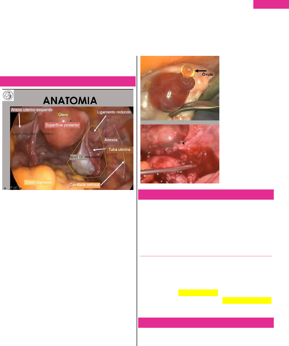 Ooforectomia laparoscópica para massa ovariana sólida