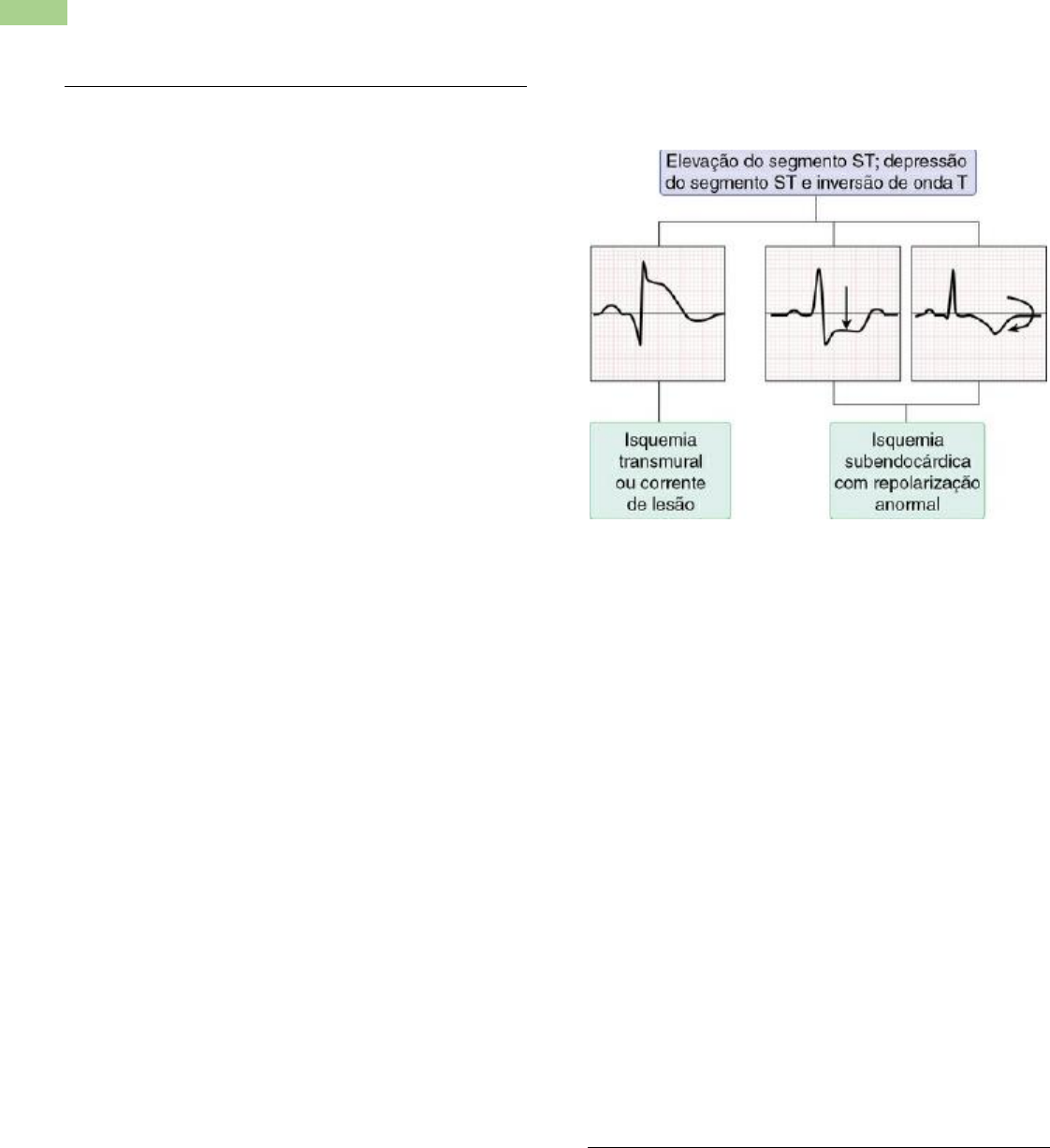 Nova diretriz de dor torácica 2025 A diretriz brasileira de dor torácica  reforça o foco em diagnóstico precoce na emergência, com o objetivo de  identificar casos de isquemia e oclusão coronariana o ..., image size:1122x1227