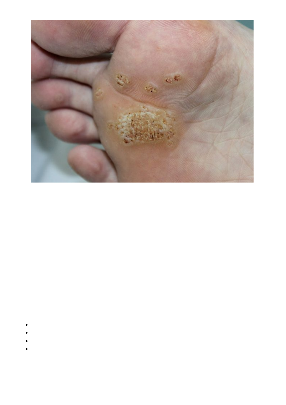 Cirurgia Dermatológica | Dermatologista em João Pessoa - Azzouz Dermatologia, image size:1190x1684