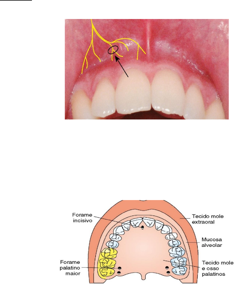 1 -Anatomia do incisivo lateral inferior (32). A -Face vestibular