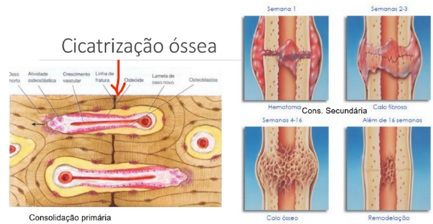 CICATRIZAÇÃO ÓSSEA E MÉTODOS DE FIXAÇÃO - De Pequenos Animais